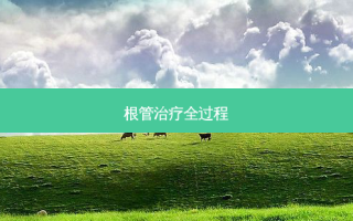 根管全过程
