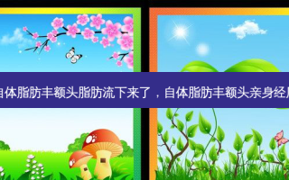 自体脂肪丰额头脂肪流下来了，自体脂肪丰额头亲身经历