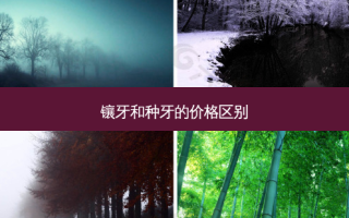 镶牙和种牙的价格区别