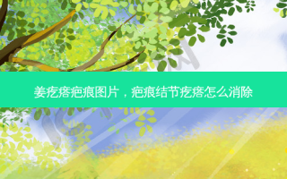 姜疙瘩疤痕图片，疤痕结节疙瘩怎么消除