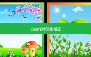 自锁托槽牙齿矫正