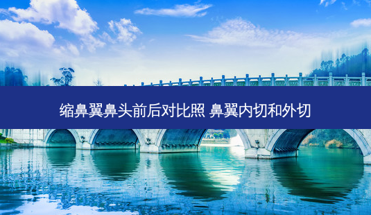 缩鼻翼鼻头前后对比照 鼻翼内切和外切-第1张图片-容颜讯 缩鼻翼鼻头前后对比照 鼻翼内切和外切-第1张图片-容颜讯