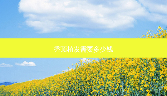 秃顶植发需要多少钱-第1张图片-容颜讯