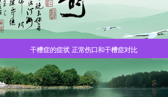 干槽症的症状 正常伤口和干槽症对比-第1张图片-容颜讯 干槽症的症状 正常伤口和干槽症对比-第1张图片-容颜讯