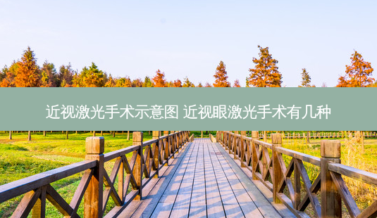 近视激光手术示意图 近视眼激光手术有几种-第1张图片-容颜讯
