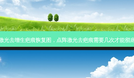 点阵激光去增生疤痕恢复图,点阵激光去疤痕需要几次才能彻底消除-第1张图片-容颜讯 点阵激光去增生疤痕恢复图,点阵激光去疤痕需要几次才能彻底消除-第1张图片-容颜讯
