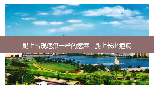 腿上出现疤痕一样的疙瘩,腿上长出疤痕-第1张图片-容颜讯 腿上出现疤痕一样的疙瘩,腿上长出疤痕-第1张图片-容颜讯