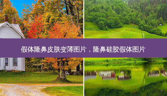 假体隆鼻皮肤变薄图片,隆鼻硅胶假体图片-第1张图片-容颜讯 假体隆鼻皮肤变薄图片,隆鼻硅胶假体图片-第1张图片-容颜讯