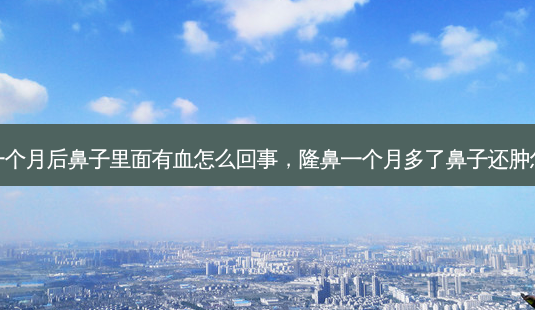 隆鼻一个月后鼻子里面有血怎么回事,隆鼻一个月多了鼻子还肿怎么办-第1张图片-容颜讯 隆鼻一个月后鼻子里面有血怎么回事,隆鼻一个月多了鼻子还肿怎么办-第1张图片-容颜讯