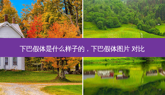 下巴假体是什么样子的,下巴假体图片 对比-第1张图片-容颜讯 下巴假体是什么样子的,下巴假体图片 对比-第1张图片-容颜讯