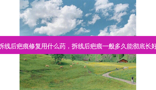 拆线后疤痕修复用什么药,拆线后疤痕一般多久能彻底长好-第1张图片-容颜讯 拆线后疤痕修复用什么药,拆线后疤痕一般多久能彻底长好-第1张图片-容颜讯