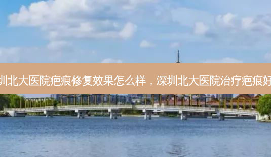 深圳北大医院疤痕修复效果怎么样,深圳北大医院疤痕好吗-第1张图片-容颜讯 深圳北大医院疤痕修复效果怎么样,深圳北大医院疤痕好吗-第1张图片-容颜讯