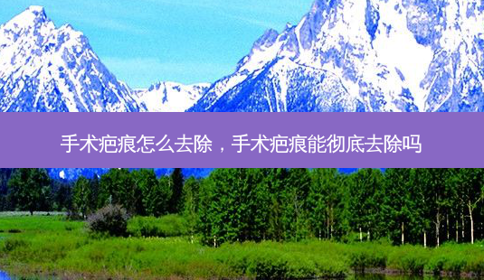 手术疤痕怎么去除,手术疤痕能彻底去除吗-第1张图片-容颜讯 手术疤痕怎么去除,手术疤痕能彻底去除吗-第1张图片-容颜讯