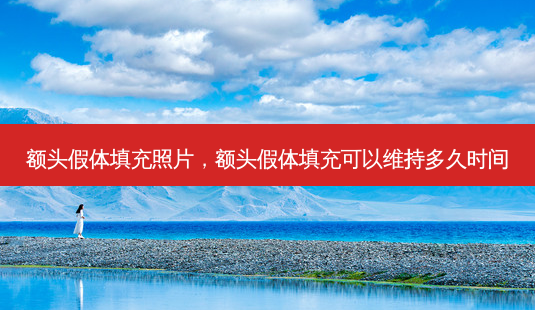 额头假体填充照片,额头假体填充可以维持多久时间-第1张图片-容颜讯 额头假体填充照片,额头假体填充可以维持多久时间-第1张图片-容颜讯