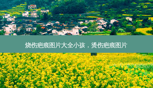 烧伤疤痕图片大全小孩，烫伤疤痕图片-第1张图片-容颜讯