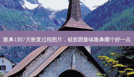 隆鼻1到7天恢复过程图片,硅胶跟膨体隆鼻哪个好一点-第1张图片-容颜讯 隆鼻1到7天恢复过程图片,硅胶跟膨体隆鼻哪个好一点-第1张图片-容颜讯