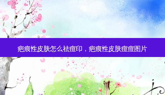 疤痕性皮肤怎么祛痘印，疤痕性皮肤痘痘图片-第1张图片-容颜讯