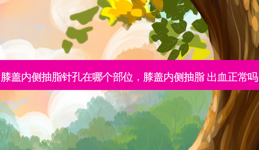 膝盖内侧抽脂针孔在哪个部位,膝盖内侧抽脂 出血正常吗-第1张图片-容颜讯 膝盖内侧抽脂针孔在哪个部位,膝盖内侧抽脂 出血正常吗-第1张图片-容颜讯