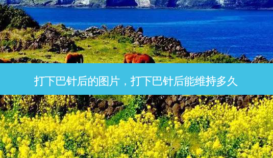 打下巴针后的图片，打下巴针后能维持多久-第1张图片-容颜讯