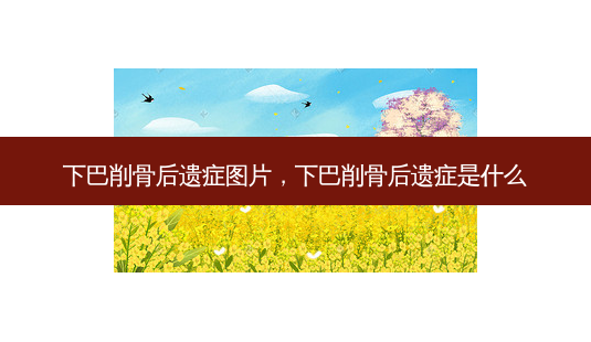 下巴削骨后遗症图片，下巴削骨后遗症是什么-第1张图片-容颜讯