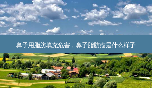 鼻子用脂肪填充危害,鼻子脂肪瘤是什么样子-第1张图片-容颜讯 鼻子用脂肪填充危害,鼻子脂肪瘤是什么样子-第1张图片-容颜讯
