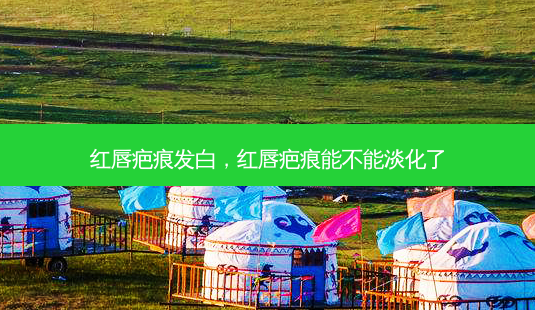 红唇疤痕发白,红唇疤痕能不能淡化了-第1张图片-容颜讯 红唇疤痕发白,红唇疤痕能不能淡化了-第1张图片-容颜讯