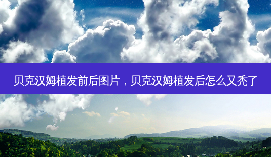 贝克汉姆植发前后图片,贝克汉姆植发后怎么又秃了-第1张图片-容颜讯 贝克汉姆植发前后图片,贝克汉姆植发后怎么又秃了-第1张图片-容颜讯