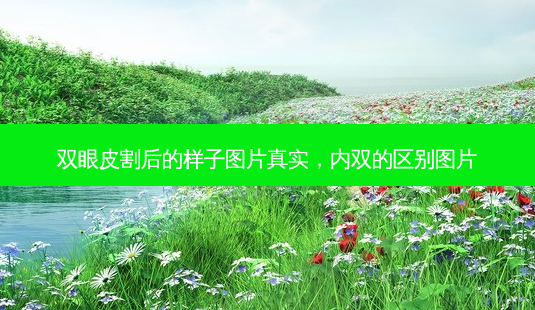 双眼皮割后的样子图片真实,内双的区别图片-第1张图片-容颜讯 双眼皮割后的样子图片真实,内双的区别图片-第1张图片-容颜讯