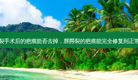 唇腭裂手术后的疤痕能否去掉,唇腭裂的疤痕能完全修复到正常人么-第1张图片-容颜讯 唇腭裂手术后的疤痕能否去掉,唇腭裂的疤痕能完全修复到正常人么-第1张图片-容颜讯