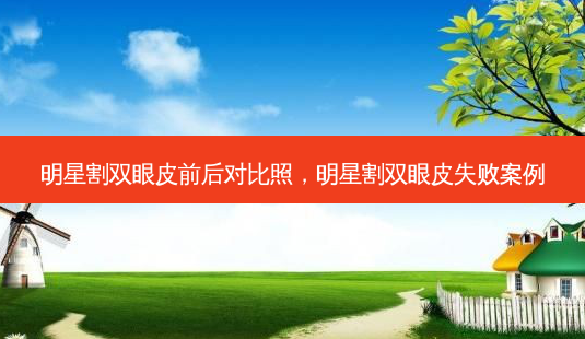 明星割双眼皮前后对比照,明星割双眼皮失败案例-第1张图片-容颜讯 明星割双眼皮前后对比照,明星割双眼皮失败案例-第1张图片-容颜讯