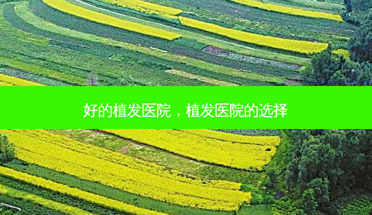 好的植发医院,植发医院的选择-第1张图片-容颜讯 好的植发医院,植发医院的选择-第1张图片-容颜讯