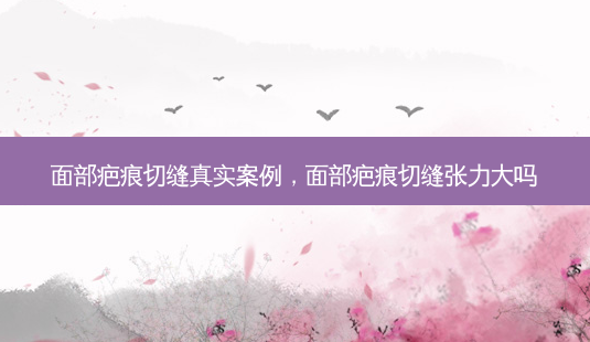 面部疤痕切缝真实案例，面部疤痕切缝张力大吗-第1张图片-容颜讯