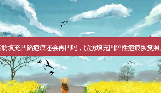 脂肪填充凹陷疤痕还会再凹吗,脂肪填充凹陷性疤痕恢复照片-第1张图片-容颜讯 脂肪填充凹陷疤痕还会再凹吗,脂肪填充凹陷性疤痕恢复照片-第1张图片-容颜讯