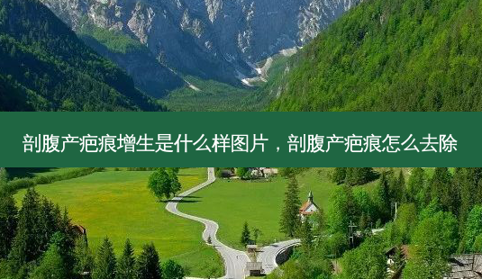 剖腹产疤痕增生是什么样图片,剖腹产疤痕怎么去除-第1张图片-容颜讯 剖腹产疤痕增生是什么样图片,剖腹产疤痕怎么去除-第1张图片-容颜讯