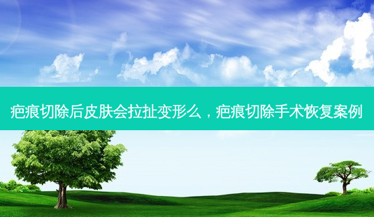 疤痕切除后皮肤会拉扯变形么,疤痕切除手术恢复案例-第1张图片-容颜讯 疤痕切除后皮肤会拉扯变形么,疤痕切除手术恢复案例-第1张图片-容颜讯