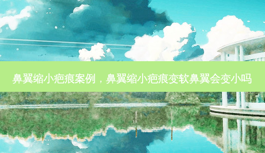 鼻翼缩小疤痕案例,鼻翼缩小疤痕变软鼻翼会变小吗-第1张图片-容颜讯 鼻翼缩小疤痕案例,鼻翼缩小疤痕变软鼻翼会变小吗-第1张图片-容颜讯