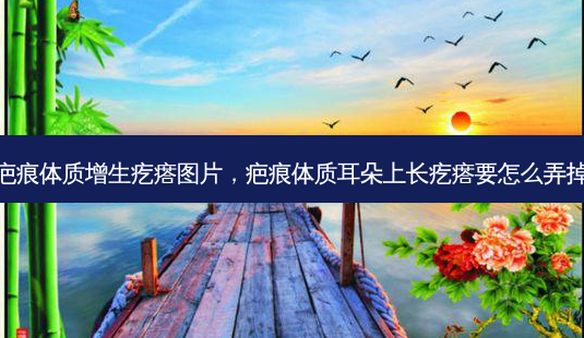疤痕体质增生疙瘩图片，疤痕体质耳朵上长疙瘩要怎么弄掉-第1张图片-容颜讯