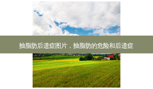 抽脂肪后遗症图片,抽脂肪的危险和后遗症-第1张图片-容颜讯 抽脂肪后遗症图片,抽脂肪的危险和后遗症-第1张图片-容颜讯