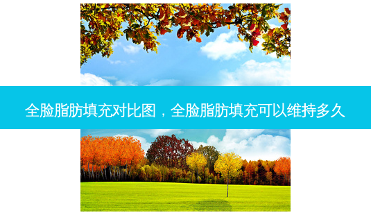 全脸脂肪填充对比图,全脸脂肪填充可以维持多久-第1张图片-容颜讯 全脸脂肪填充对比图,全脸脂肪填充可以维持多久-第1张图片-容颜讯