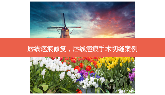 唇线疤痕修复,唇线疤痕手术切缝案例-第1张图片-容颜讯 唇线疤痕修复,唇线疤痕手术切缝案例-第1张图片-容颜讯