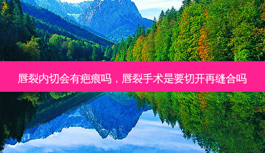 唇裂内切会有疤痕吗，唇裂手术是要切开再缝合吗-第1张图片-容颜讯