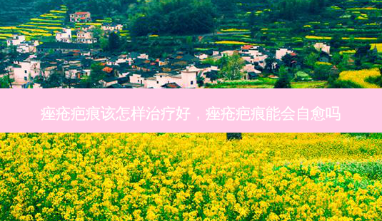 痤疮疤痕该怎样治疗好，痤疮疤痕能会自愈吗-第1张图片-容颜讯