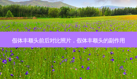 假体丰额头前后对比照片,假体丰额头的副作用-第1张图片-容颜讯 假体丰额头前后对比照片,假体丰额头的副作用-第1张图片-容颜讯