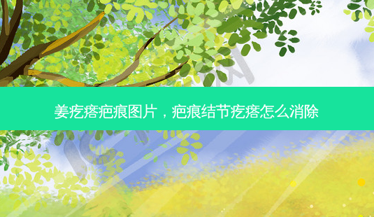 姜疙瘩疤痕图片,疤痕结节疙瘩怎么消除-第1张图片-容颜讯 姜疙瘩疤痕图片,疤痕结节疙瘩怎么消除-第1张图片-容颜讯