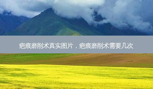 疤痕磨削术真实图片,疤痕磨削术需要几次-第1张图片-容颜讯 疤痕磨削术真实图片,疤痕磨削术需要几次-第1张图片-容颜讯