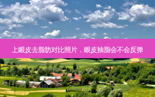 上眼皮去脂肪对比照片，眼皮抽脂会不会反弹