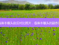 假体丰额头前后对比照片，假体丰额头的副作用