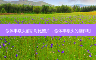 假体丰额头前后对比照片，假体丰额头的副作用