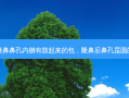 隆鼻鼻孔内侧有鼓起来的包，隆鼻后鼻孔是圆的