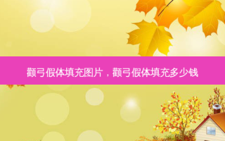 颧弓假体填充图片，颧弓假体填充多少钱